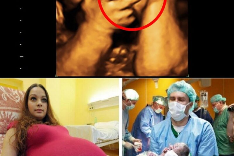 Mom Thinks She’s Pregnant With Twins, Doctor Freezes When He Sees Her Ultrasound