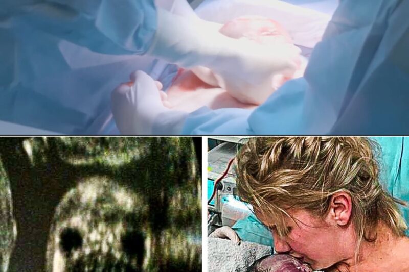 This Mom Gave Birth To A Healthy Baby But When Doctors Saw Her Placenta, They Left It Inside Her