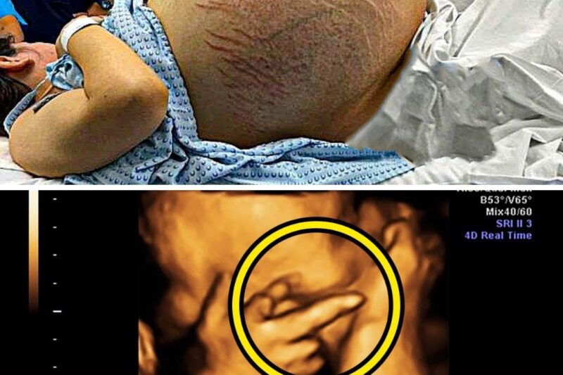 Mom Thinks She’s Pregnant With Twins, Doctor Freezes When He Sees Her Ultrasound