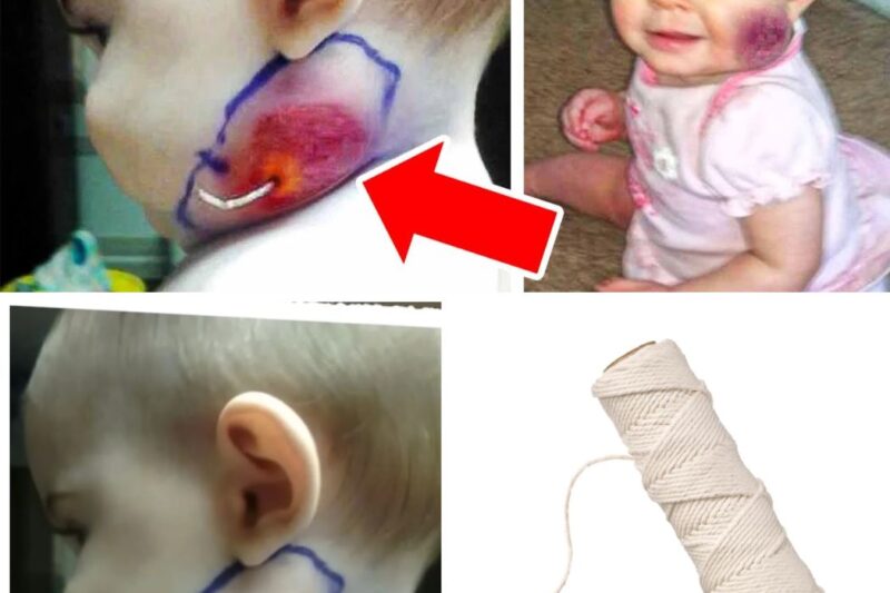 Mom Spots String Growing Out of Baby’s Face, Doctors Were Shocked To Find This…