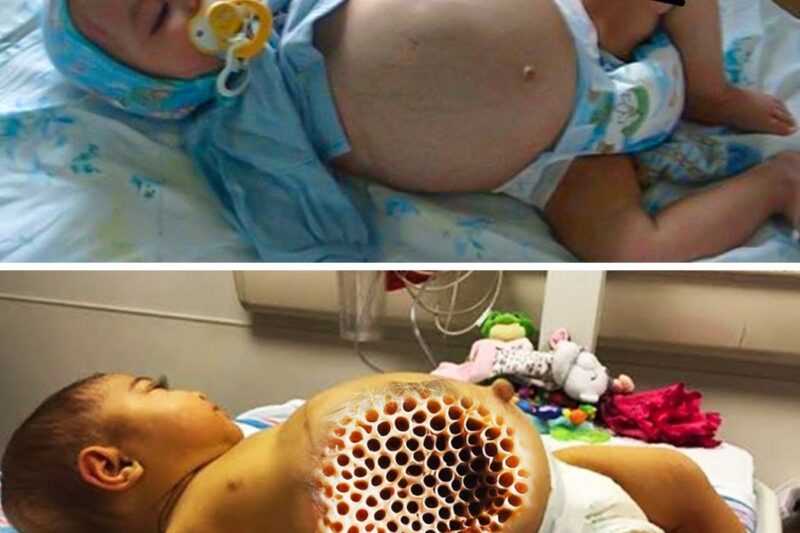 Baby’s Belly Keeps Growing, Doctor Sees Ultrasound And Asks Mom To Leave Room