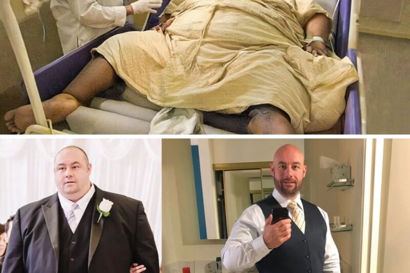 REMEMBER THIS MAN WHO WEIGHED 1022 POUNDS? This Is How He Looks Now!