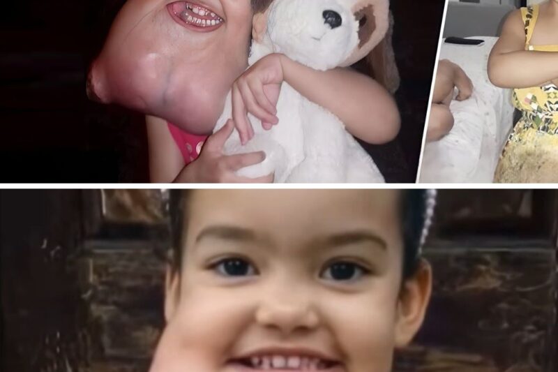The world’s biggest Chin baby’s turned 10 years old, and this is what She look like now!