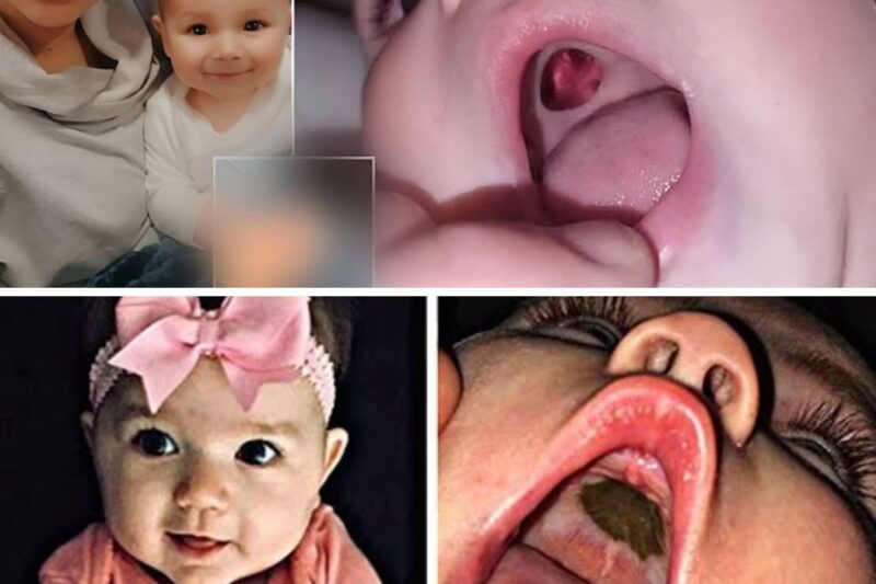 Mom Spots Hole Growing inside of Baby’s Mouth, Doctors Were Shocked To Find This…