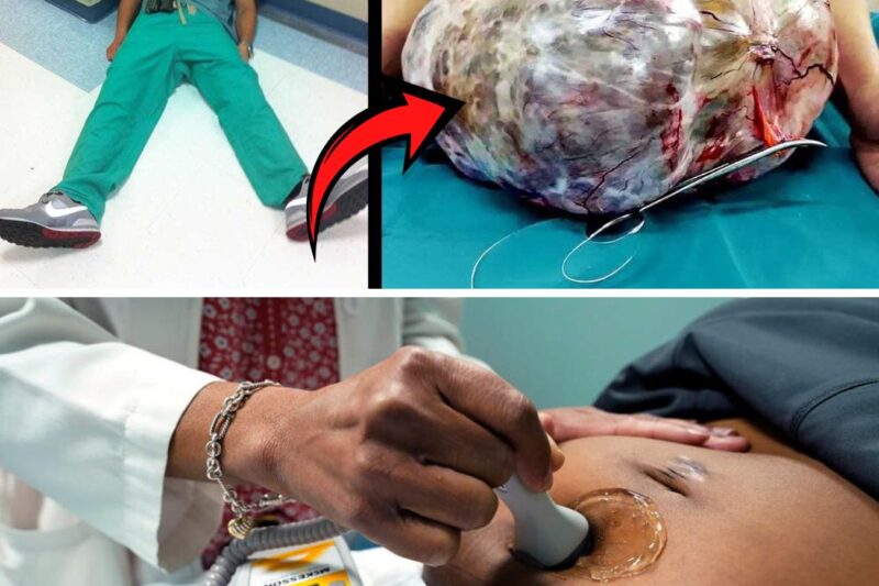 WOMAN Has “PREGNANCY COMPLICATIONS” Doctor Faints When He Sees This On Ultrasound