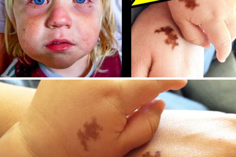Mom Adopts Girl With SAME BIRTHMARK As Husband, Doctor Sees It And Tells Her To File For Divorce