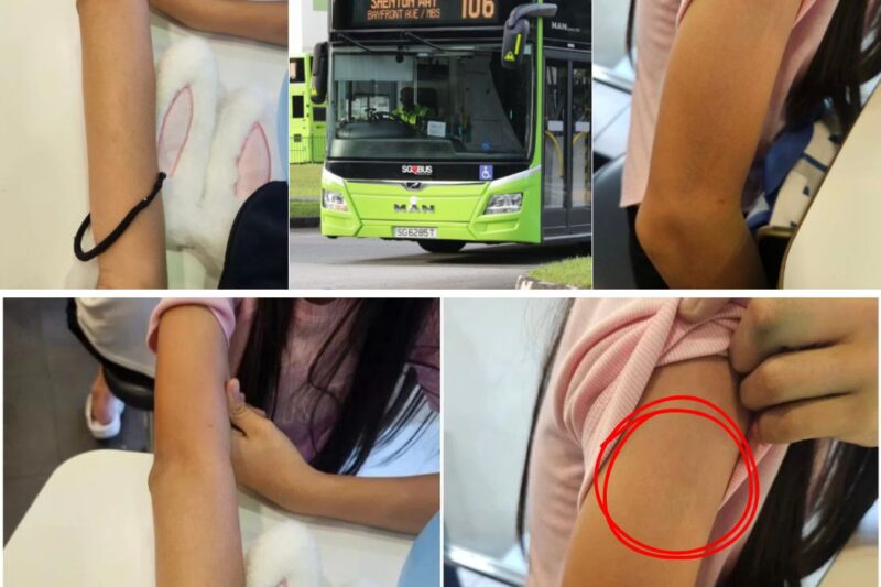 Bus Driver Sees Scribbling On Girl’s Arm, Calls 911