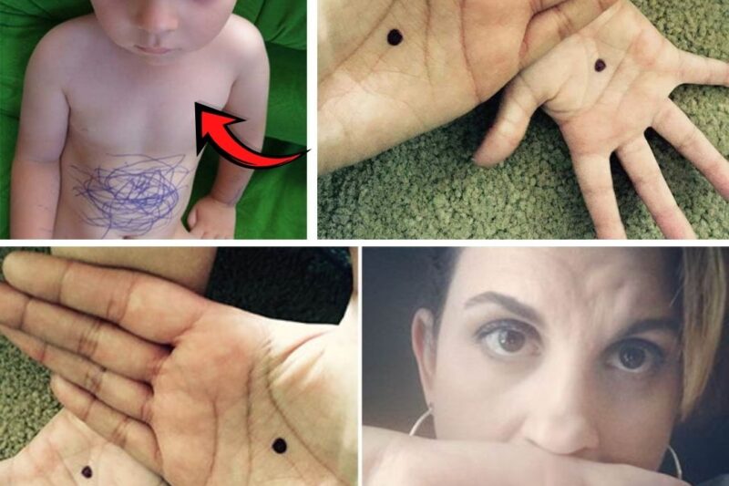 MAN Sees HOMELESS BOY With Identical Birthmark, Turns Pale Realizing What It Means
