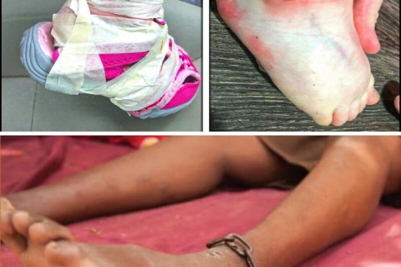 MOM Picks Up Daughter From Daycare, Sees Her Feet And Calls 911