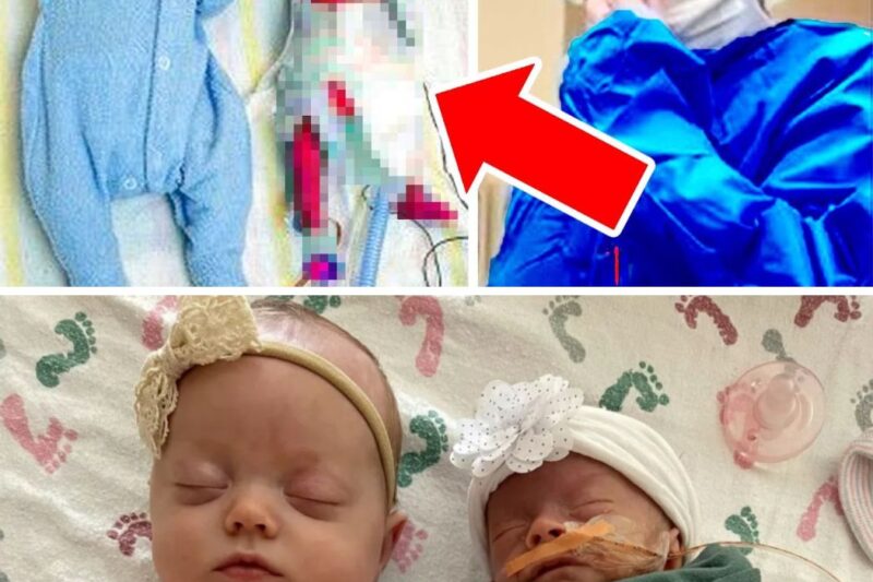Mother Gives Birth To Twin Girls, Doctor Tells Her ‘ I’m Sorry For You ‘