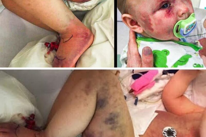 Mom Thought Son Was Stung By Wasp, Realizes Truth When He Turns Blue