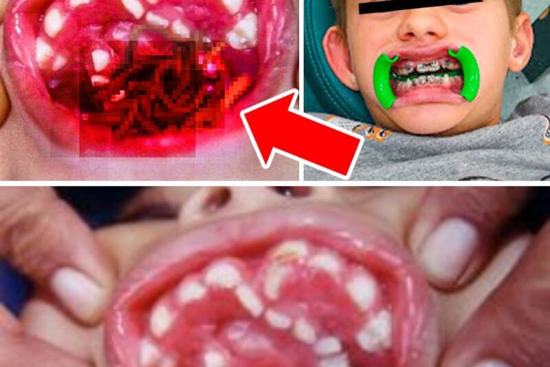 BOY Couldn’t Speak A Word, Dentist Found This…