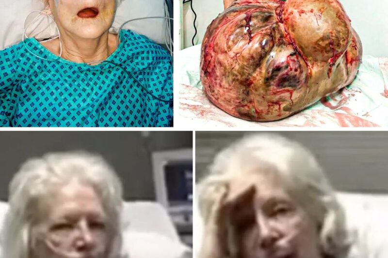 Elderly Woman Thinks She’s DYING, Then Doctor Reveals What They Found Inside Her