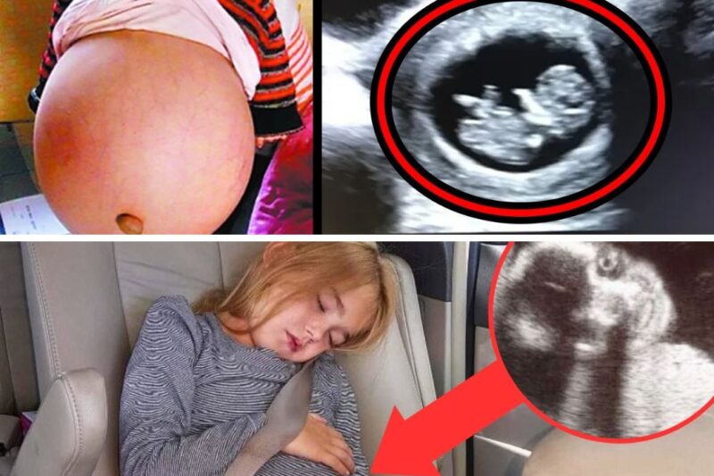 8-Year-Old Girl Is Told She Looks Pregnant in School. Her Parents Rush Her for an Ultrasound