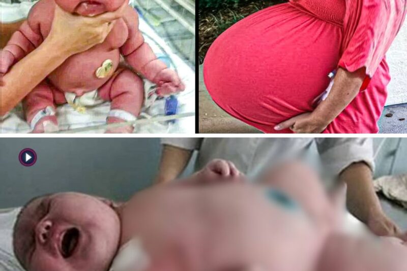 They thought she was carrying 8 babies. No one was prepared when it came time for her to give birth