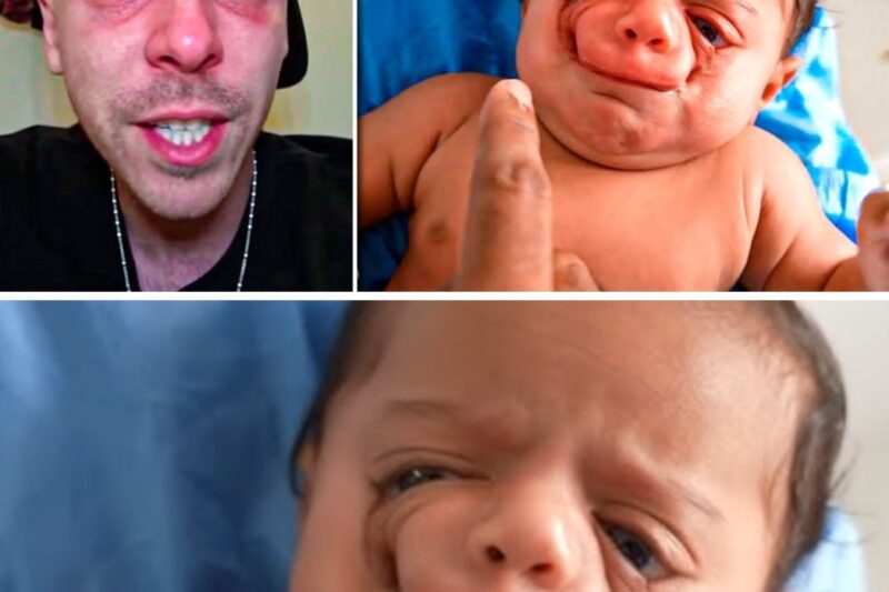 Dad Is Horrified Seeing Newborn Son – “He doesn’t look like a person” he said