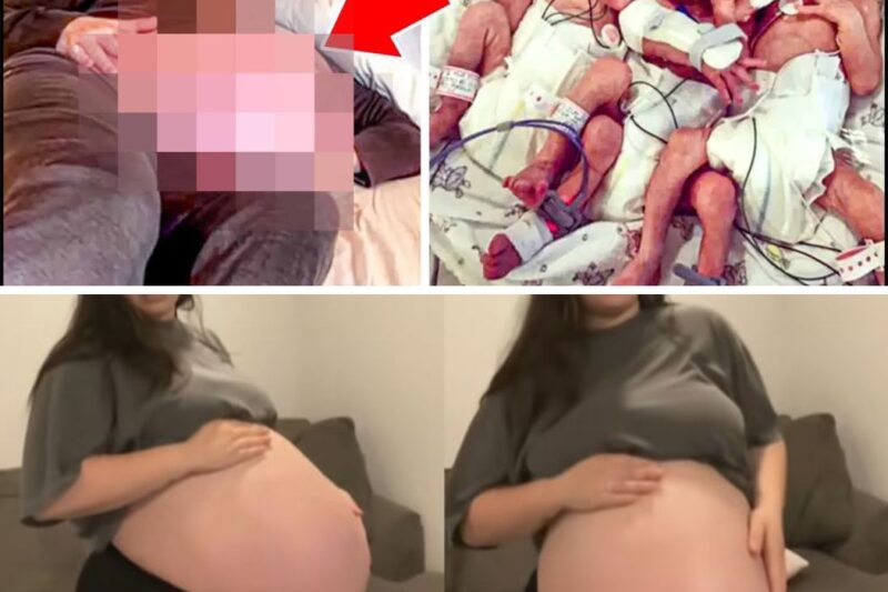 After Giving Birth to Twins — Her Belly Became ‘Huge’