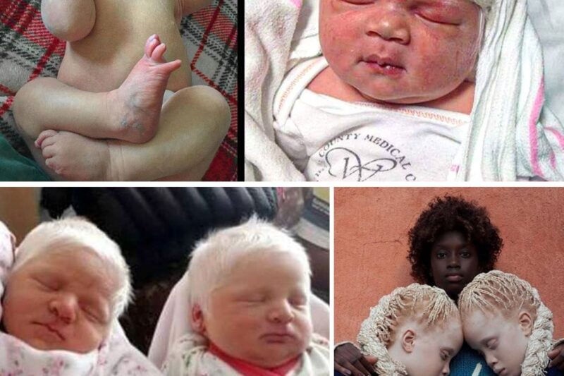 Mom Gives Birth to Twins with Snow-White Hair, They Show Their Unusual Beauty Years Later