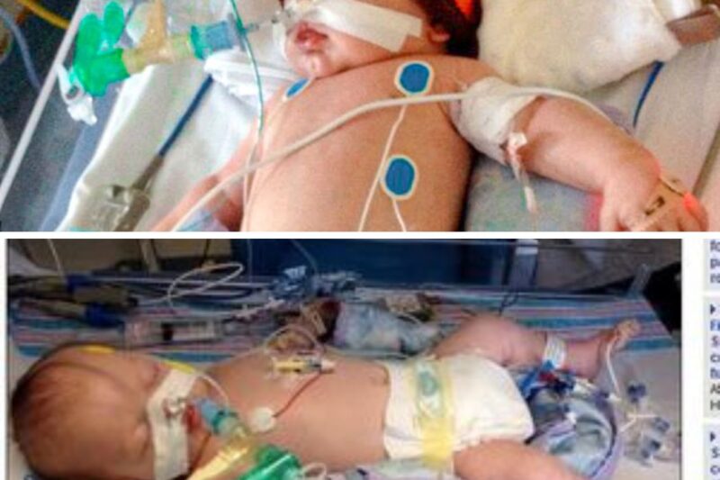 Courts Ordered This Baby Off Life Support, But His Parents Did The Unthinkable