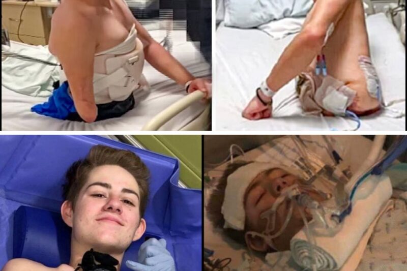 This guy got chopped in half by a forklift, you won’t believe what happened next.