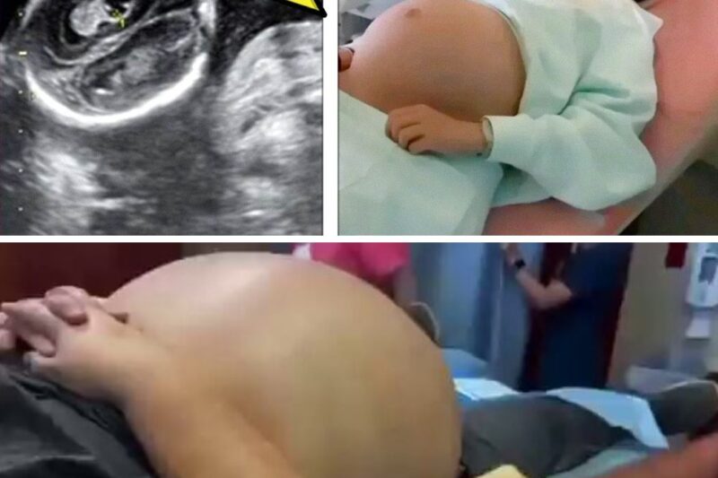 Man Takes Pregnancy Test, Gets Unusual Results