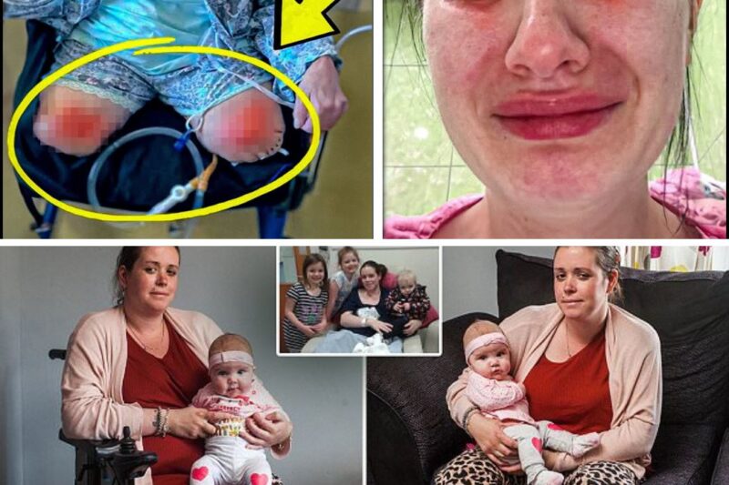 Mom of 8 Wakes up after C-Section Horrified to See She No Longer Has Legs