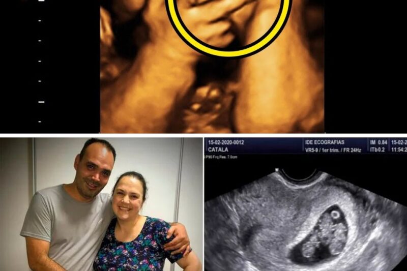 Mom Thinks She’s Pregnant With Triplets, Doctor Freezes When He Sees Her Ultrasound