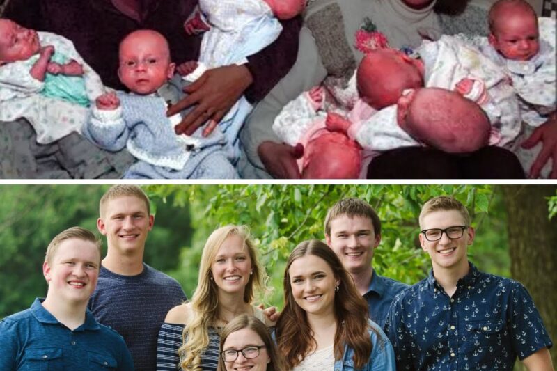 First Surviving Septuplets – Where Are They 20 Years Later?
