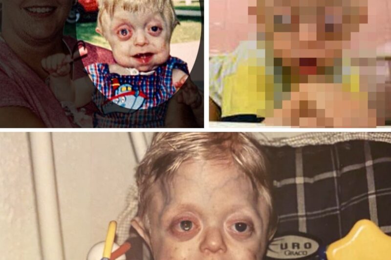 They said he wouldn’t live past 18 months. You won’t believe what he looks like today