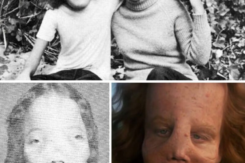 Rocky Dennis The true story of the boy who inspired ‘Mask’
